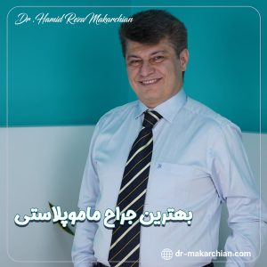 جراح ماموپلاستی - دکتر حمیدرضا مکارچیان