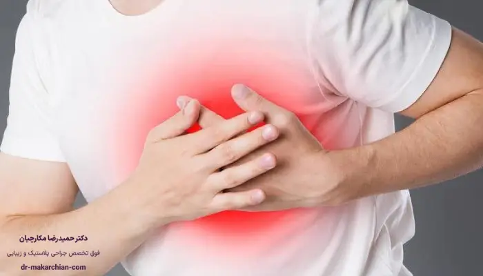آمبولی بعد از ابدومینوپلاستی